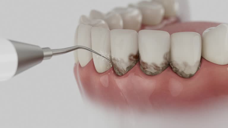 Reliable Tooth Extraction contractor in Scottsbluff, NE by Smile Center Dentistry